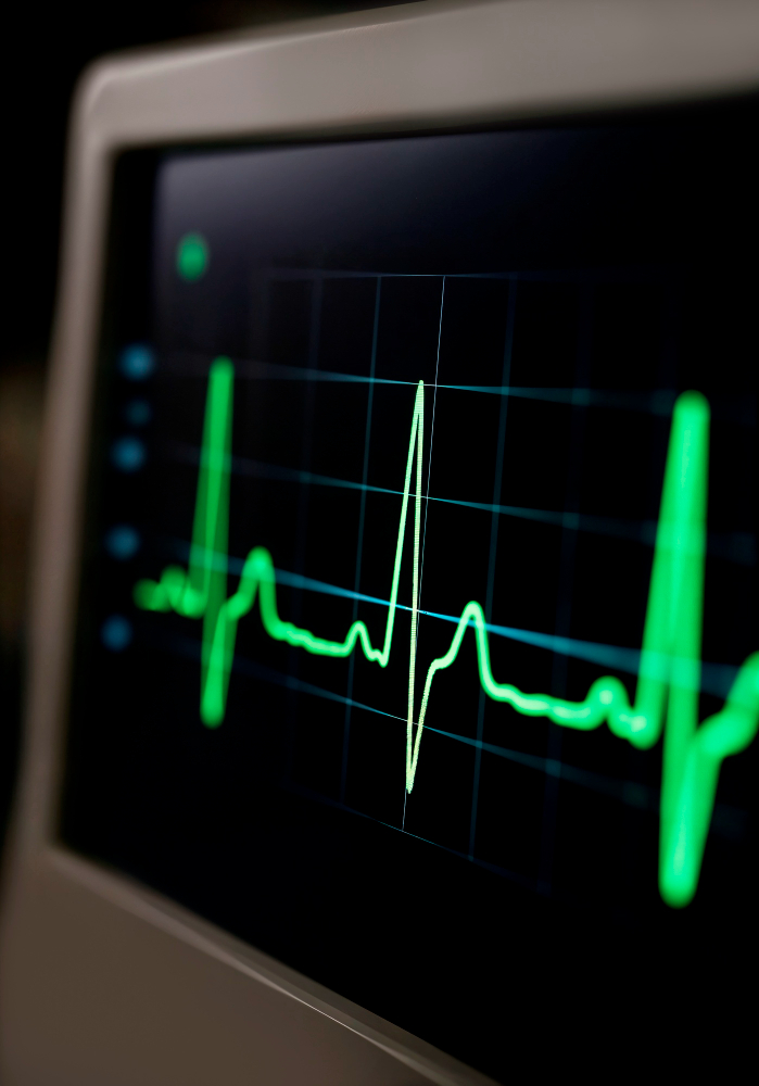 ECG test
