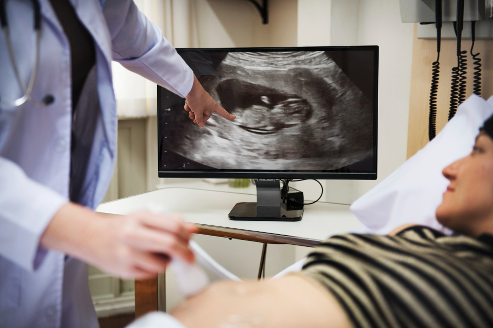 Ultrasound scanning